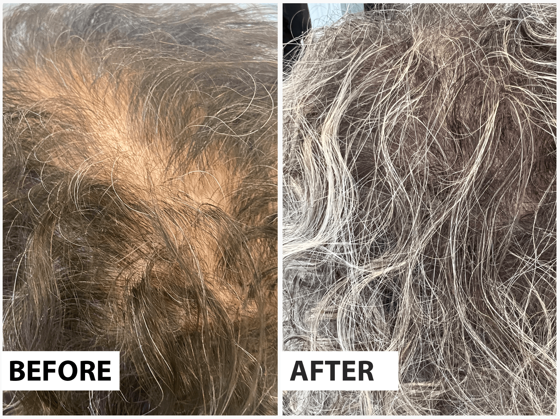 before and after photo after using AOB Hair Oil 